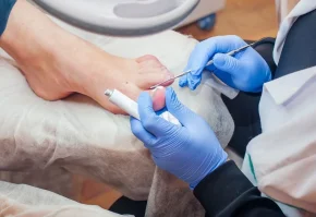 nailsurgery